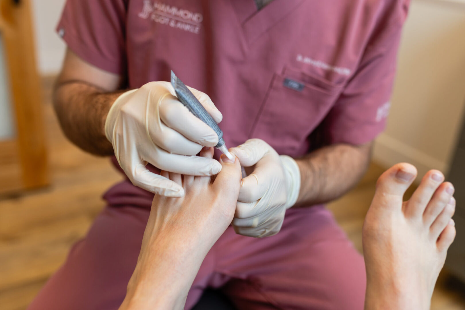 A person is getting their nails trimmed by a doctor.